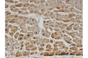 Image no. 1 for anti-Zinc Finger Protein 239 (ZNF239) (AA 1-101) antibody (ABIN599472)
