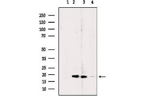 Western blot analysis of extracts from various samples, using RPL24 Antibody. (RPL24 Antikörper  (Internal Region))