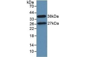 Western Blotting (WB) image for anti-Signal Transducing Adaptor Molecule (SH3 Domain and ITAM Motif) 1 (STAM) (AA 196-465) antibody (ABIN7442918)