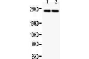 Western Blotting (WB) image for anti-Dicer 1, Ribonuclease Type III (DICER1) (AA 1-195) antibody (ABIN3043347)