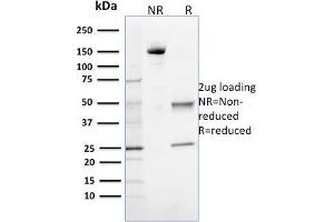 SDS-PAGE Analysis Purified 8-oxoguanine Mouse Monoclonal Antibody (CPTC-OGG1-1). (OGG1 Antikörper)