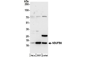 anti-NADH Dehydrogenase (Ubiquinone) 1 beta Subcomplex, 6, 17kDa (NDUFB6) (AA 1-50) antibody