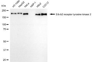 Western blotting analysis using Erb-b2 receptor tyrosine kinase 2 antibody (ABIN7800156).