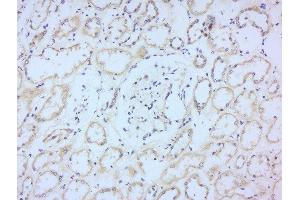 Paraformaldehyde-fixed, paraffin embedded human kidney, Antigen retrieval by boiling in sodium citrate buffer (pH6) for 15min, Block endogenous peroxidase by 3% hydrogen peroxide for 30 minutes, Blocking buffer (normal goat serum) at 37°C for 20min, Antibody incubation with Rabbit Anti-CD244 Polyclonal Antibody, Unconjugated  at 1:200 overnight at 4°C, followed by a conjugated secondary for 90 minutes and DAB staining. (2B4 Antikörper  (AA 151-250))