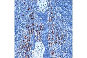 Immunohistochemistry of paraffin-embedded mouse spleen using NAIP Rabbit mAb (ABIN7268931) at dilution of 1:100 (40x lens). (NAIP Antikörper)
