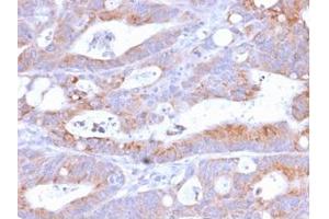 Formalin-fixed, paraffin-embedded human Colon stained with CD86 Rabbit Recombinant Monoclonal Antibody (C86/2160R). (Rekombinanter CD86 Antikörper)