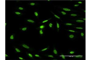 Immunofluorescence of monoclonal antibody to ISL1 on HeLa cell. (ISL1 Antikörper  (AA 63-159))
