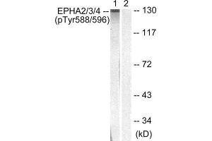 Western Blotting (WB) image for anti-Eph Receptor A2+A3 (EPHA2/3) (pTyr588), (pTyr596) antibody (ABIN1847362) (EPHA2/3 Antikörper  (pTyr588, pTyr596))
