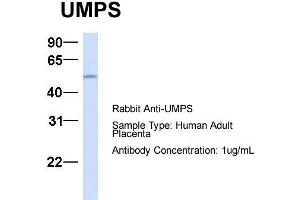 Host:  Rabbit  Target Name:  UMPS  Sample Type:  Human Adult Placenta  Antibody Dilution:  1. (UMPS Antikörper  (C-Term))