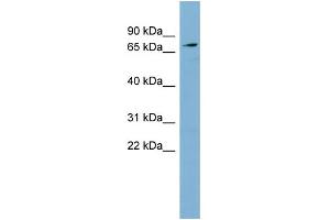 WB Suggested Anti-SLC7A2 Antibody Titration:  0. (SLC7A2 Antikörper  (Middle Region))