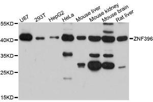 Western blot analysis of extracts of various cell lines, using ZNF396 antibody (ABIN6291098) at 1:3000 dilution. (ZNF396 Antikörper)
