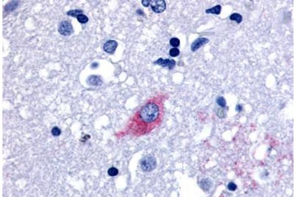 LGR4 Antikörper  (Cytoplasmic Domain)