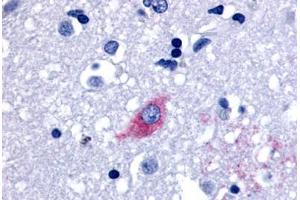 Anti-LGR4 antibody  ABIN1049003 IHC staining of human brain, neurons and glia.
