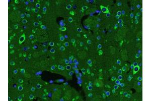 Immunohistochemistry (Paraffin-embedded Sections) (IHC (p)) image for anti-Brain-Derived Neurotrophic Factor (BDNF) (AA 151-247) antibody (ABIN1387788)
