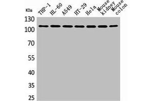 Western Blot analysis of THP-1 H460 A549 HT29 HeLa mouse kidney mouse colon cells using cPLA2 Polyclonal Antibody (PLA2G4A Antikörper  (N-Term))