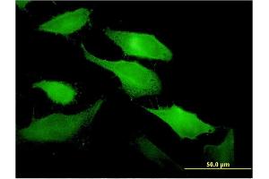 Immunofluorescence of monoclonal antibody to TNFSF11 on HeLa cell. (RANKL Antikörper  (AA 222-316))
