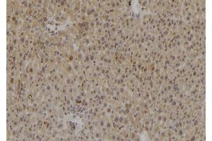 ABIN6269361 at 1/100 staining Rat liver tissue by IHC-P. (Caspase 8 Antikörper)