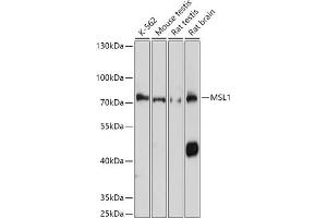 Western blot analysis of extracts of various cell lines, using MSL1 antibody (ABIN7268383) at 1:1000 dilution. (MSL1 Antikörper  (AA 210-300))