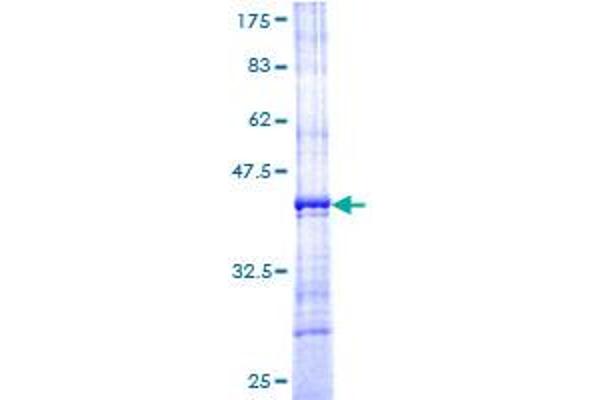 RPL10A Protein (AA 108-217) (GST tag)