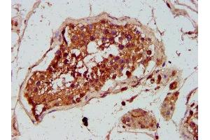 IHC image of ABIN7154448 diluted at 1:300 and staining in paraffin-embedded human testis tissue performed on a Leica BondTM system. (GREM1 Antikörper  (AA 18-184))