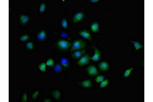 Immunofluorescent analysis of A549 cells using ABIN7173895 at dilution of 1:100 and Alexa Fluor 488-congugated AffiniPure Goat Anti-Rabbit IgG(H+L) (CD137 Antikörper  (AA 24-186))