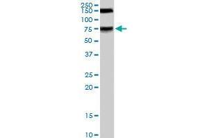 MELK polyclonal antibody  staining (0. (MELK Antikörper)