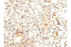 ABIN6267072 at 1/100 staining mouse lung tissue sections by IHC-P. (JAK1 Antikörper  (pTyr1022, pTyr1023))