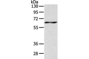 Gel: 8 % SDS-PAGE, Lysate: 80 μg, Lane: Mouse spleen tissue, Primary antibody: ABIN7191331(LZTS1 Antibody) at dilution 1/200 dilution, Secondary antibody: Goat anti rabbit IgG at 1/8000 dilution, Exposure time: 10 seconds