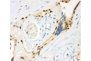 IHC-P: MSK1 antibody testing of human placenta tissue (MSK1 Antikörper  (AA 540-665))