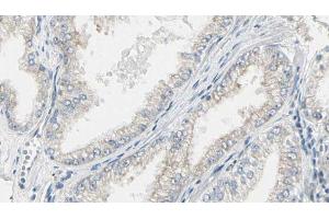 ABIN6267468 at 1/100 staining Human prostate tissue by IHC-P. (CDC25B Antikörper  (pSer353))