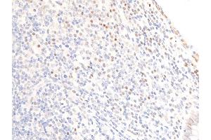 ABIN6256098 and ABIN6267269 at 1/100 staining human appendiceal tissue sections by IHC-P.