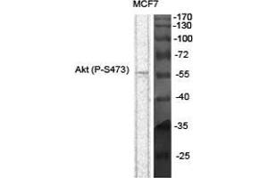 Western Blot (WB) analysis of specific cells using Phospho-Akt (S473) Polyclonal Antibody.