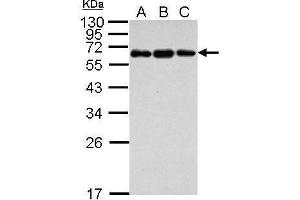 WB Image Sample (30 ug of whole cell lysate) A: Jurkat B: Raji C: K562 12% SDS PAGE antibody diluted at 1:1000 (C4BPB Antikörper)