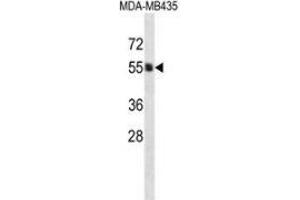 Western blot analysis in MDA-MB435 cell line lysates (35ug/lane) using PIGA  Antibody . (PIGA Antikörper  (C-Term))
