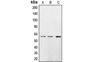 Western blot analysis of CaMK2 delta expression in HeLa (A), A431 (B), H1299 (C) whole cell lysates. (CAMK2D Antikörper  (Center))