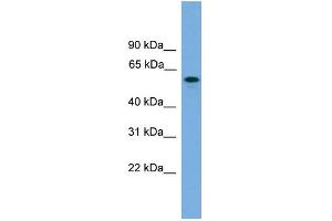 WB Suggested Anti-KIAA1609 Antibody Titration: 0. (KIAA1609 Antikörper  (Middle Region))