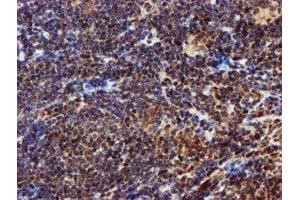 Image no. 6 for anti-EPM2A (Laforin) Interacting Protein 1 (EPM2AIP1) antibody (ABIN1498045) (EPM2AIP1 Antikörper)