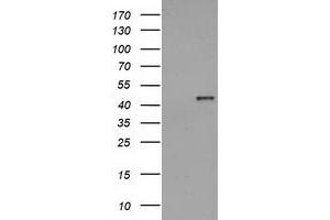 Western Blotting (WB) image for anti-Hydroxyacid Oxidase (Glycolate Oxidase) 1 (HAO1) antibody (ABIN1498575) (HAO1 Antikörper)