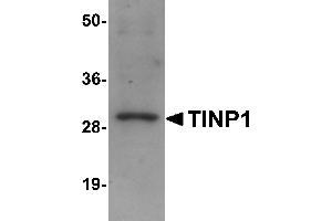 Western Blotting (WB) image for anti-NSA2 Ribosome Biogenesis Homolog (NSA2) (C-Term) antibody (ABIN1030737) (NSA2 Antikörper  (C-Term))