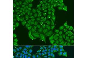 Immunofluorescence analysis of U2OS cells using ATPIF1 Polyclonal Antibody at dilution of 1:100. (ATPase Inhibitory Factor 1 Antikörper)