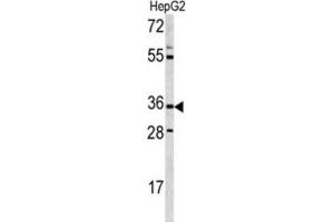 Western Blotting (WB) image for anti-CD38 antibody (ABIN3001687) (CD38 Antikörper)