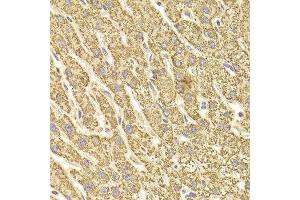 Immunohistochemistry of paraffin-embedded Human liver injury using ATP5B antibody at dilution of 1:100 (x400 lens).