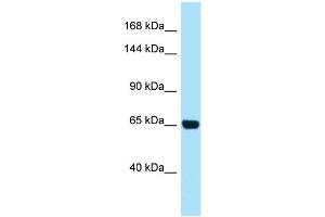 WB Suggested Anti-PALB2 AntibodyTitration: 1. (PALB2 Antikörper  (N-Term))