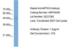 WB Suggested Anti-NPTX2  Antibody Titration: 0.