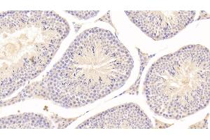 Detection of GLb in Mouse Testis Tissue using Polyclonal Antibody to Galactosidase Beta (GLb)
