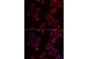 Immunofluorescence analysis of U2OS cells using NCR1 antibody (ABIN5973838). (NCR1 Antikörper)
