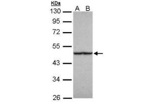 WB Image Sample (30 ug of whole cell lysate) A: HeLa B: Hep G2 , 10% SDS PAGE antibody diluted at 1:1000 (FH Antikörper)