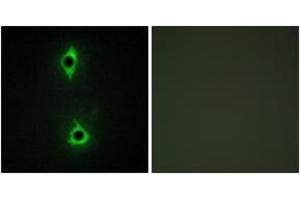 Immunofluorescence analysis of COS7 cells, using PIP5K Antibody.