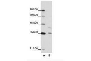 Image no. 1 for anti-Naked Cuticle Homolog 2 (NKD2) (AA 43-92) antibody (ABIN6736218) (NKD2 Antikörper  (AA 43-92))