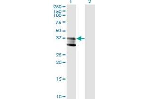 Western Blot analysis of SMPD1 expression in transfected 293T cell line by SMPD1 monoclonal antibody (M01), clone 4H2. (SMPD1 Antikörper  (AA 1-364))